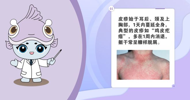 这个病尚无疫苗预防出现发热、咽痛、皮疹等症状马上去医院→(图2)